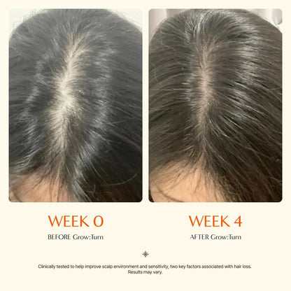 Hair Growth Serum with Built in Brush - Hair Growth & Thickening Serum for Scalp Nourishment
