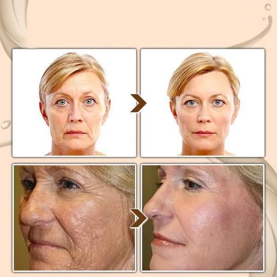 ⏰Final 6 Hours: Only $11.99🔥[Dr.Meloxin Official] Cemenrete Calcium Multi Balm | Anti-aging, Sagging, Wrinkles 💫